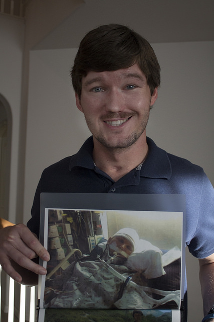 Adam Stelmach holds up a photo of when he was in a coma after his accident that left him with a tramuatic brain injury. Photo credit by Trevor Stamp