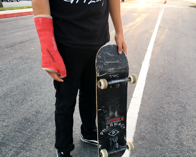 Rick Molina boke his arm on campus last week, but continues to skate.